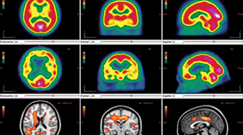 VignetteSite_Planetneuro