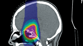 VignetteSite_ISOgrayProton