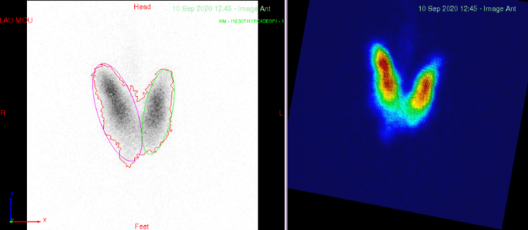 Disisoft DOSIsoft & AP-HP: A Scientific partnership on « QUANTHYR » - 1st ...